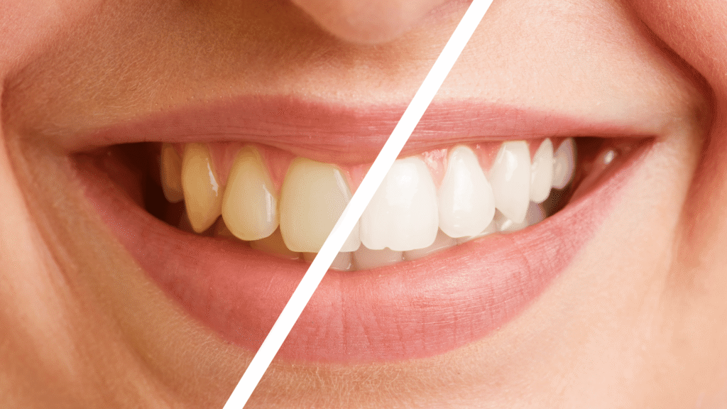Before and after comparison showing healthy, radiant skin versus dull, tired-looking skin that may indicate liver issues